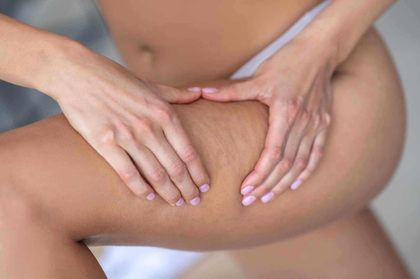 Niann cellulit terápia